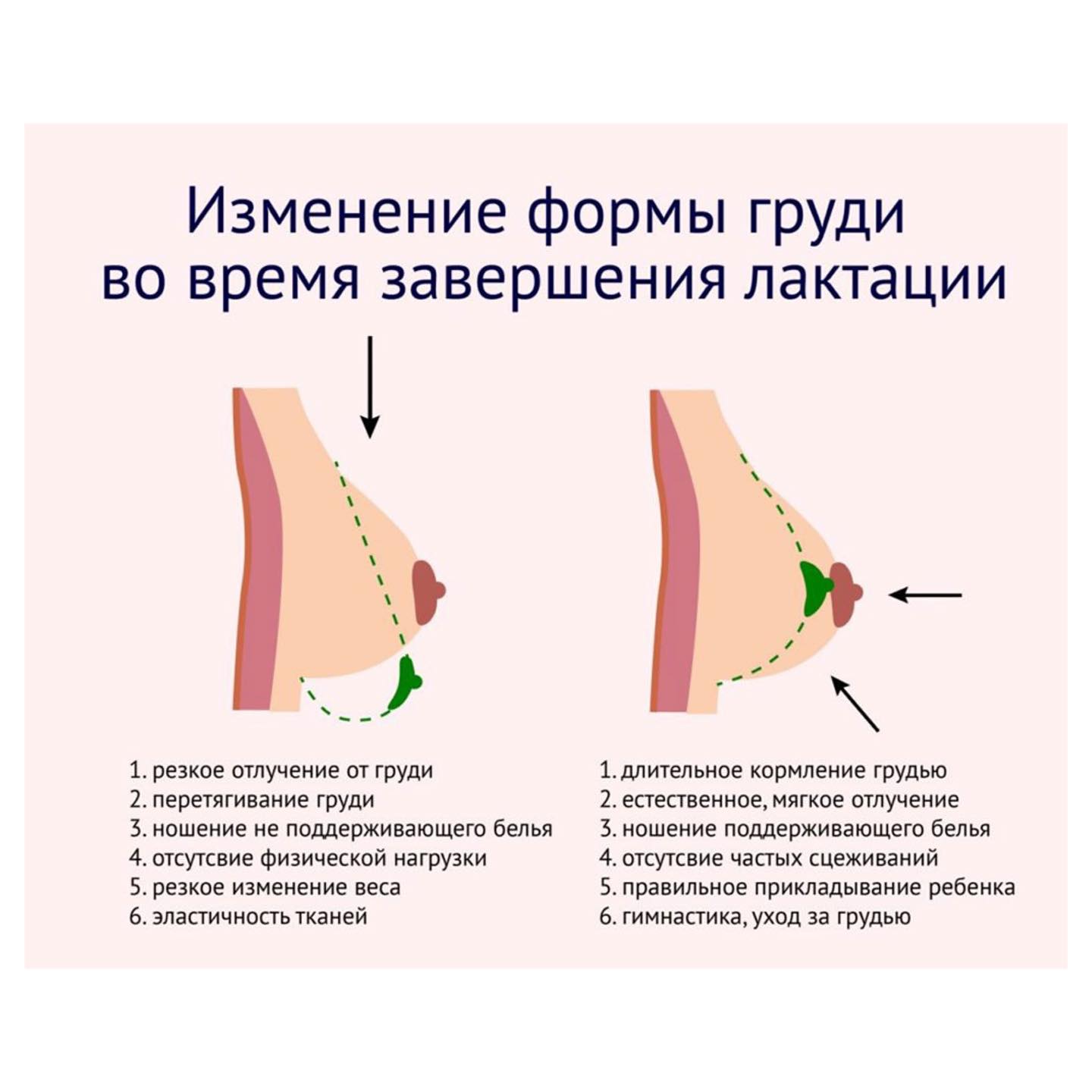 Завершение грудного вскармливания | Клиника Добрый Доктор г. Красноярск