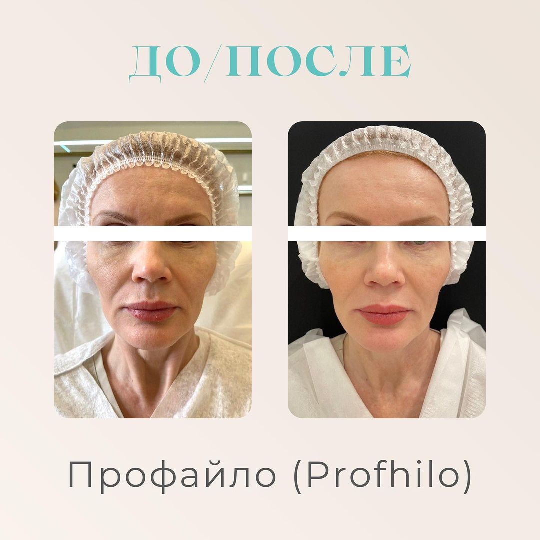 Ботулинотерапия в Красноярске: цены, отзывы, врачи Клиника Esthetique